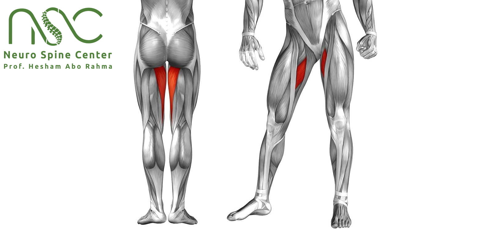 علاج اصابةالعضلة الضامة