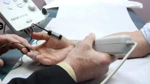 تخطيط الاعصاب